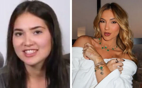 Antes e depois de Virginia Fonseca por Reprodução