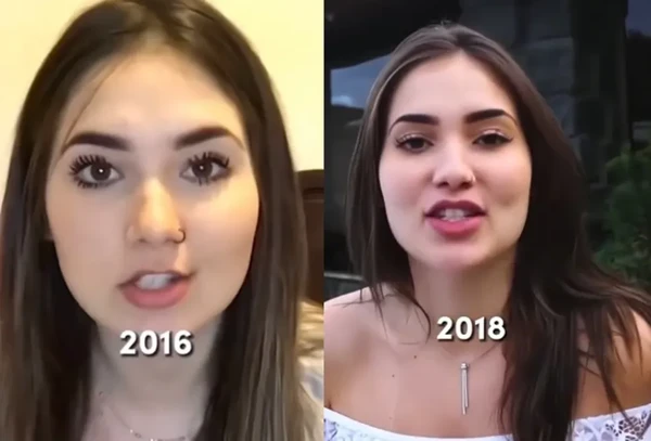 Antes e depois de Virginia Fonseca por Reprodução