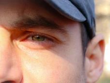 Imagem - Por que tanta gente está raspando os cílios - e qual o perigo por trás disso