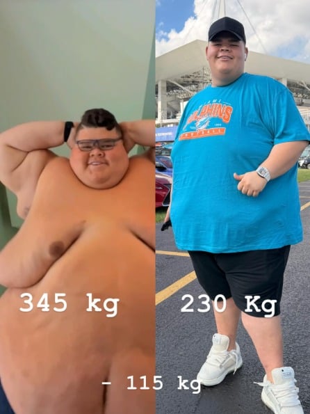Após perder 115 kg, Gordão da XJ emociona fãs com novo antes e depois por Reprodução/Redes Sociais 