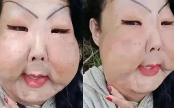 Imagens do passado da influenciadora revelam a transformação drástica