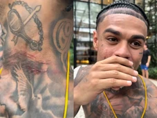 Imagem - MC Cabelinho sofre tentativa de assalto e sai ferido de festa em Salvador