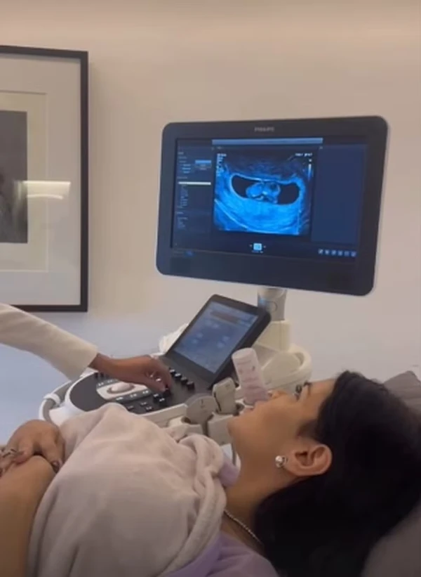 Juliana Merhy publicou um registro da ultrassonografia do bebê por Reprodução/Instagram