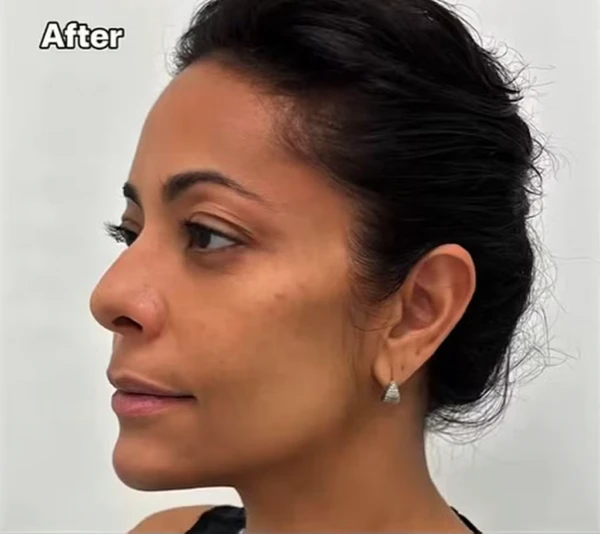 Humorista passou por procedimento na Califórnia por Reprodução | Redes Sociais