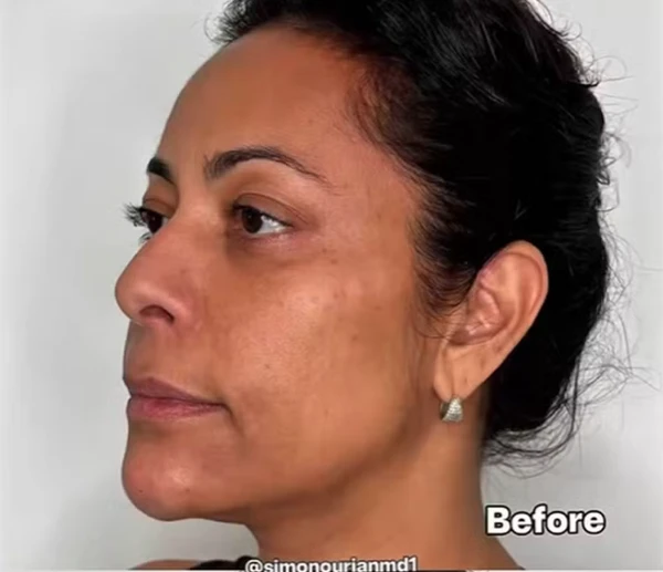 Humorista passou por procedimento na Califórnia por Reprodução | Redes Sociais