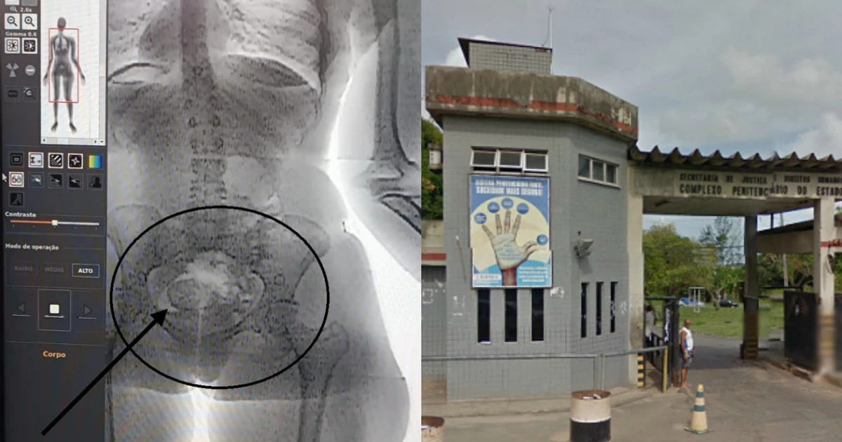 Imagem - Mulher é flagrada tentando levar droga nas partes íntimas para presídio da Mata Escura