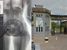 Imagem - Mulher é flagrada tentando levar droga nas partes íntimas para presídio da Mata Escura