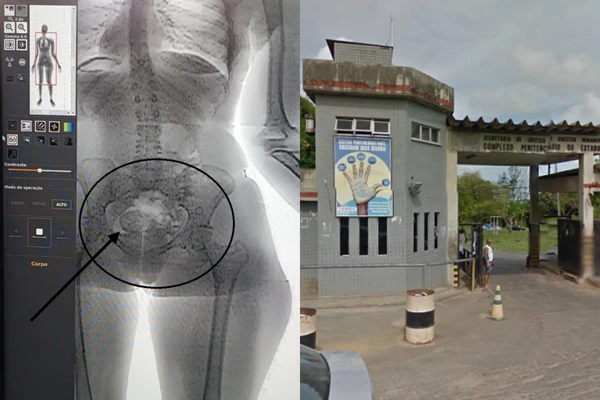 Mulher é flagrada pelo BodyScan tentando entrar com drogas nas partes íntimas na Cadeia Pública de Salvador