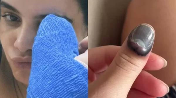  Carol Macedo precisa operar a mão após prender dedo na porta do carro por Reprodução/Redes Sociais 