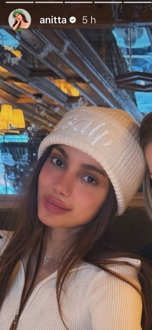 Novo rosto de Anitta por Reprodução