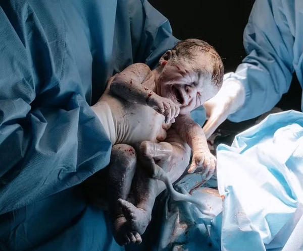 Ex-Chiquitita Carolina Chamberlain anuncia nascimento da filha, Estella por Reprodução/Instagram/@primeirominutofotografia