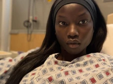 Imagem - Modelo do Ano, Anok Yai revela anomalia no coração: 'Batalha silenciosa'