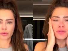 Imagem - O que aconteceu com Carolina Dieckmmann? Médica explica polêmica com rosto da atriz