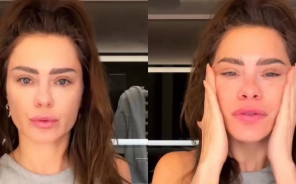 Carolina Dieckmmann apareceu com rosto diferente nas redes sociais