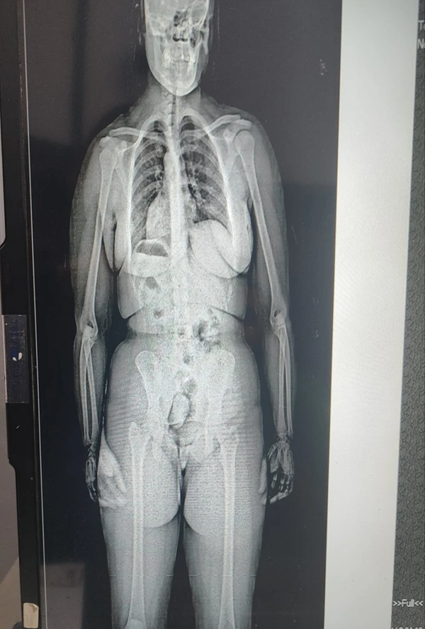 Outra mulher entrou entrar no Conjunto Penal de Eunápolis com maconha nas partes íntimas por Divulgação/ Seap