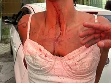 Imagem - Mulher diz que levou chute e soco de jogador após discussão em bar: ‘A justiça vai ser feita. Vou até o fim’