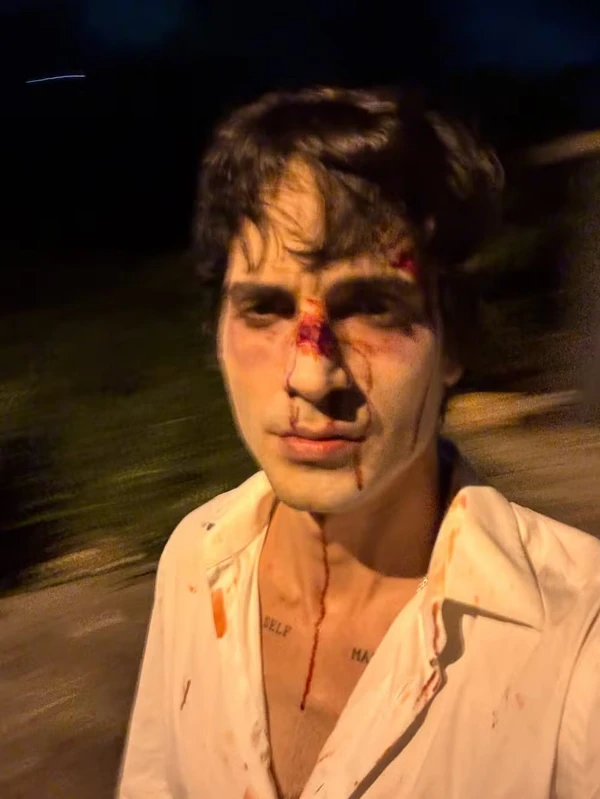 Fiuk posta foto com rosto sangrando e machucado na véspera de natal  por Reprodução/Redes Sociais 