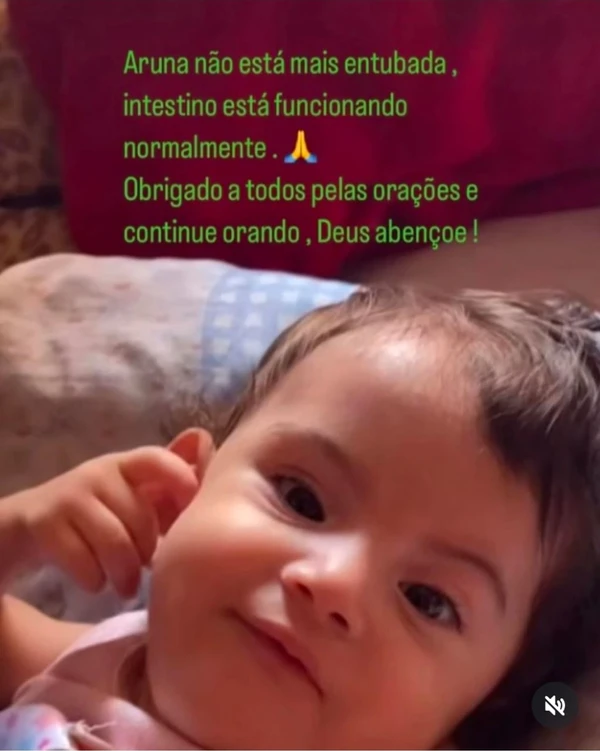 Siamesa que foi separada em Goiânia morre na véspera de Natal: 'Uma dor imensa para todos nós' por Reprodução