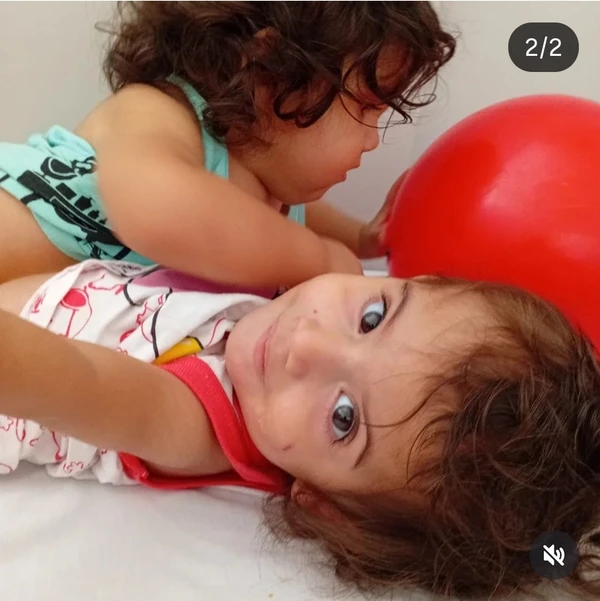 Siamesa que foi separada em Goiânia morre na véspera de Natal: 'Uma dor imensa para todos nós' por Reprodução