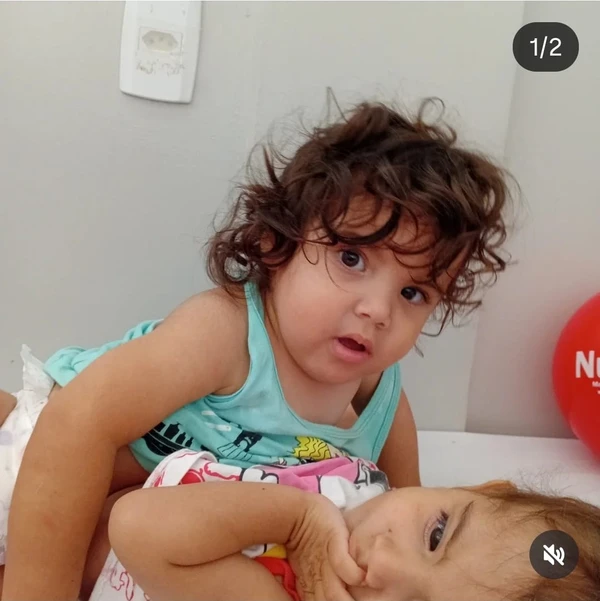 Siamesa que foi separada em Goiânia morre na véspera de Natal: 'Uma dor imensa para todos nós' por Reprodução