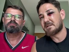 Imagem - Turista agredido por comerciantes em Porto de Galinhas diz que violência dos ataques foi maior por ser um casal gay
