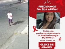 Imagem - Mulher tem perna amputada após ser atropelada por moto enquanto corria na Bahia