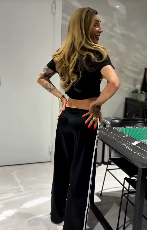 Maya Massafera passou por novo procedimento no bumbum por Reprodução/TikTok