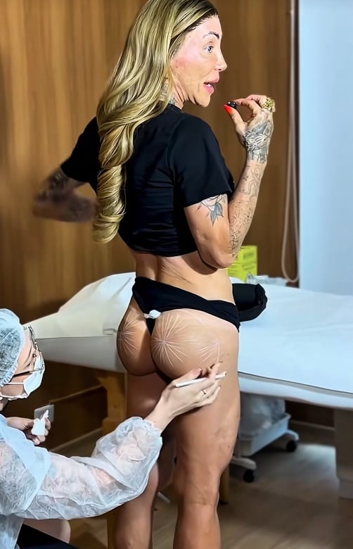 Maya Massafera passou por novo procedimento no bumbum por Reprodução/TikTok