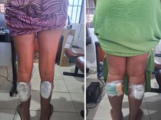 Imagem - Escondidas na panturrilha: cinco mulheres são presas ao tentar entrar com drogas em presídio de Salvador