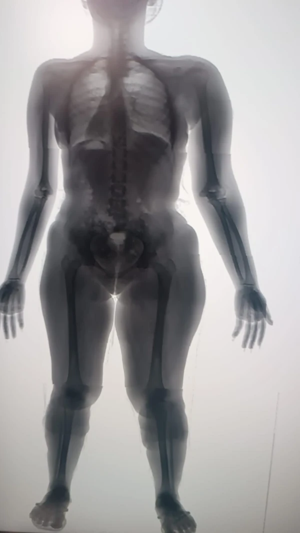 Mulheres tentam entrar em presídio de Salvador com drogas nas panturrilhas por Divulgação/Seap