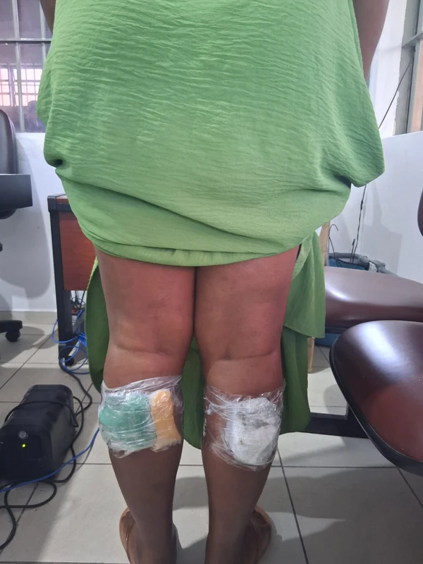 Mulheres tentam entrar em presídio de Salvador com drogas nas panturrilhas por Divulgação/Seap