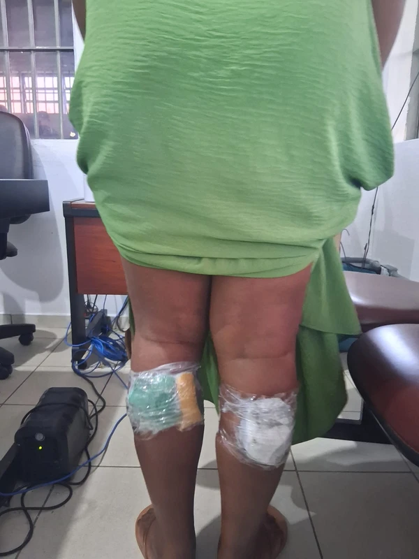 Mulheres tentam entrar em presídio de Salvador com drogas nas panturrilhas por Divulgação/Seap