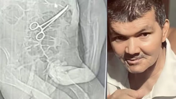 Paciente morreu após ter pinça esquecida no seu corpo