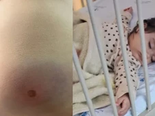 Imagem - Bebê de 11 meses é atingida por tiro de raspão durante comemoração de Réveillon