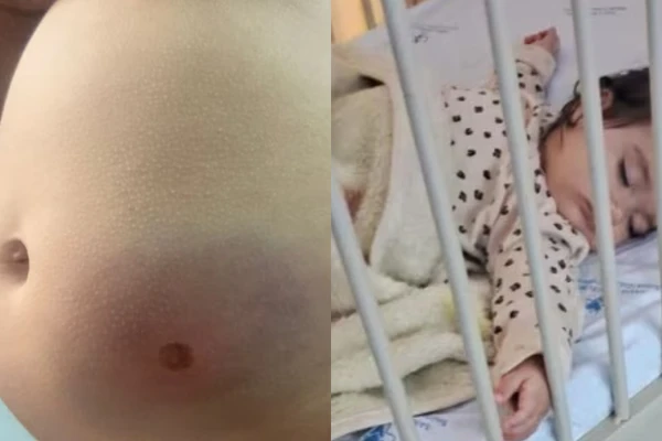 Criança foi atingida na região da barriga