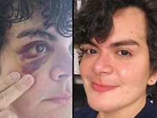 Imagem - Médico tem apartamento invadido e é espancado por vizinho: 'Falava que eu era viadinho’