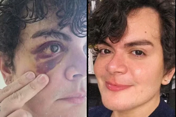 Médico tem apartamento invadido e é espancado por vizinho: “Falava que eu era ‘viadinho’”