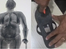 Imagem - Idosa tenta entrar em presídio com drogas e eletrônicos escondidos em muleta e chinelo