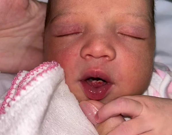 Bebê nasce com dois dentes e viraliza nas redes sociais; veja fotos por Reprodução