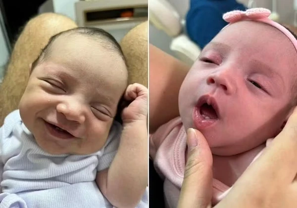 Bebê nasce com dois dentes e viraliza nas redes sociais; veja fotos por Reprodução