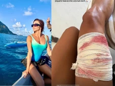 Imagem - Advogada é mordida por tubarão ao fazer snorkel durante férias