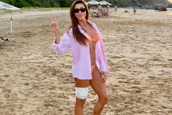 Tayane Dalazen foi mordida por um tubarão em Fernando de Noronha por Reprodução