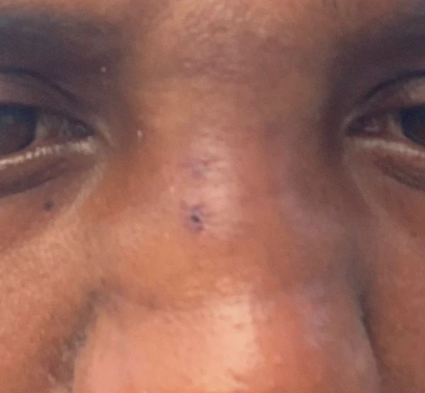 Baiano denuncia agressões em bar localizado em Santa Catarina por Reprodução