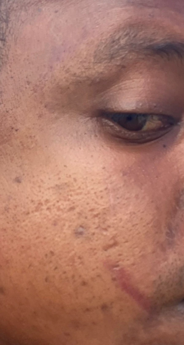 Baiano denuncia agressões em bar localizado em Santa Catarina por Reprodução