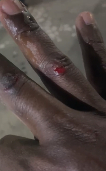 Baiano denuncia agressões em bar localizado em Santa Catarina por Reprodução