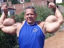 Imagem - Lembra dele? ‘Popeye Brasileiro’ morre aos 55 anos