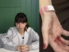 Imagem - Atriz de ‘Coração Acelerado’ é assaltada e mostra mãos feridas