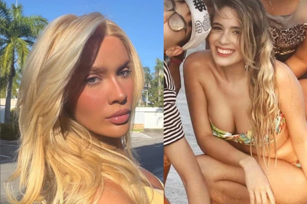 Antes e depois de Karoline Lima