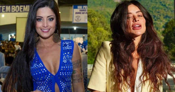 Antes e Depois: Aline Campos  por Reprodução/Redes Sociais 