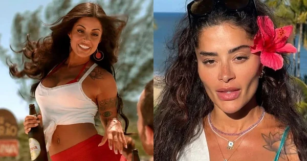 Antes e Depois: Aline Campos  por Reprodução/Redes Sociais 